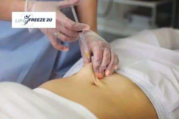 How Does Aqualyx Fat Dissolving Injection Work to Break Down Fat Leeds?