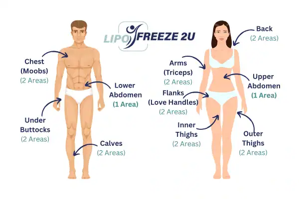 Areas you can have fat freezing treatment Leeds