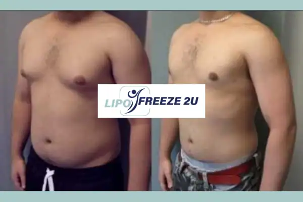How Long Does It Take to See Results Leeds?