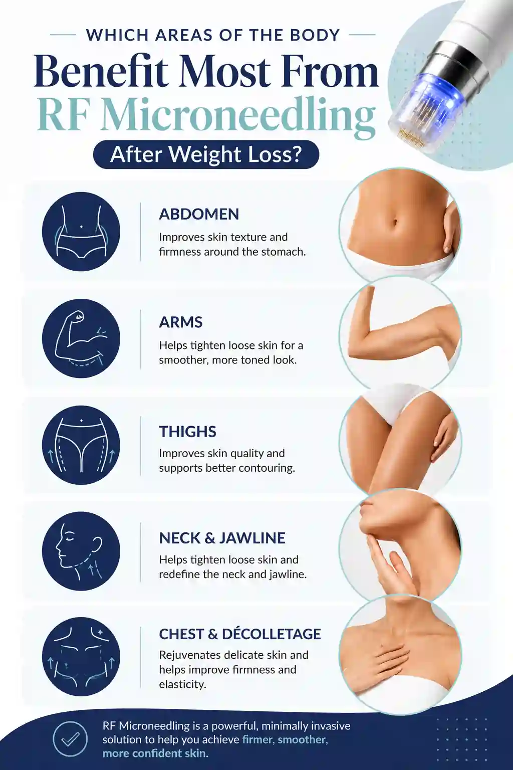 Which Areas of the Body Benefit Most From RF Microneedling After Weight Loss Leeds